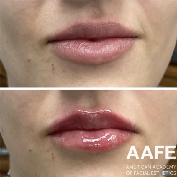 Comfortox Lips - Image 3